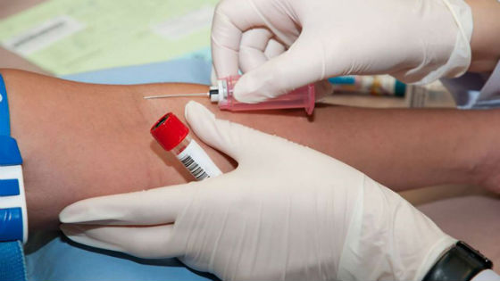 Анализ крови на инфекции и определение группы крови перед проведением операции