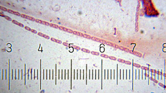 Стрептобациллы под микроскопом