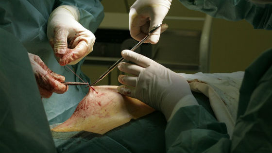 Удаление опухоли груди хирургическим способом