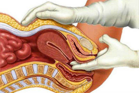 Как проводится обследование у гинеколога