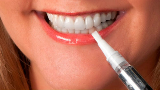 Специальные карандаши для очищения зубной эмали