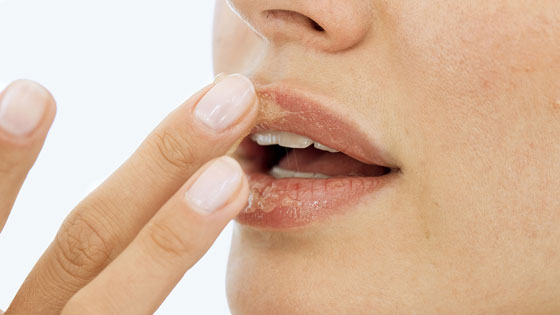 Нанесение медового скраба на кожу губ