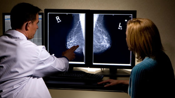 Как выглядяд кальцинаты на маммографии