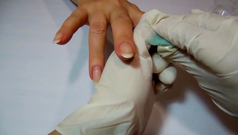 Обработка ногтевой пластины дезинфицирующими средствами