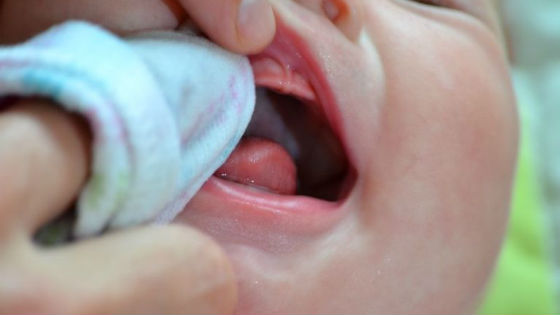 Проводить обработку полости рта от налета следует до 6 раз в день