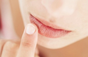 Обветренные губы, лечение и профилактика
