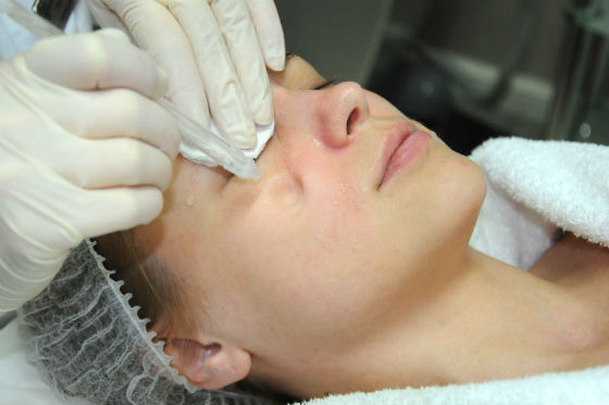 Проведение процедуры аквапилинга на лице