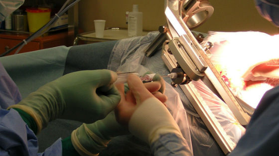 Проведение процедуры забора ткани шеечного отдела матки