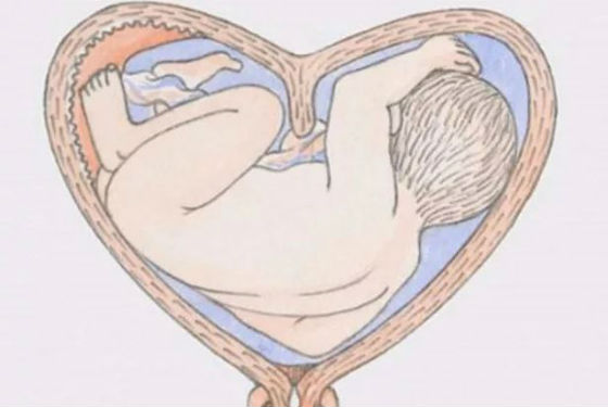 Беременность при врожденных патологиях развития внутренних половых органов