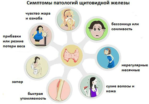 Симптомы патологических процессов в щитовидке