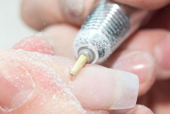 Спиливание верхней части ногтевой пластины для восстановления цвета