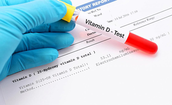 Тест на витамин Д
