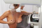 Фиброаденоматозное изменение в груди