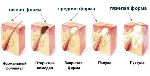 Разновидности кожных высыпаний на разных участках тела