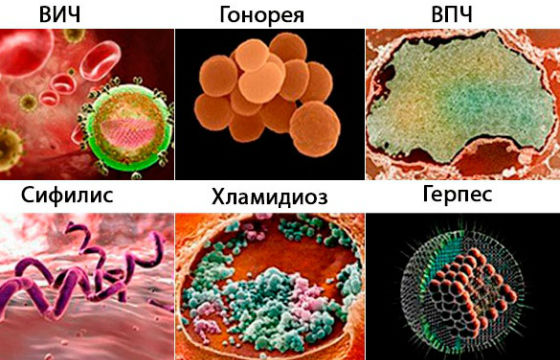 Вирусы и бактерии, которые вызывают гинекологические заболевания